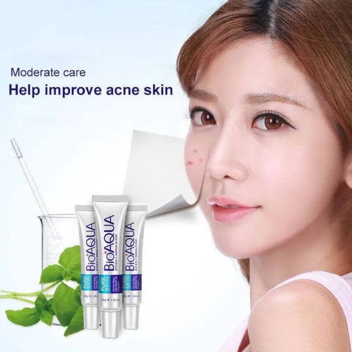 Bio aqua Acne Cream - Anti-Wrinkle Removal Cream Spots Scar Blemish Marks