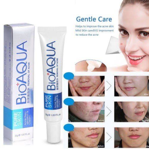 Bio aqua Acne Cream - Anti-Wrinkle Removal Cream Spots Scar Blemish Marks