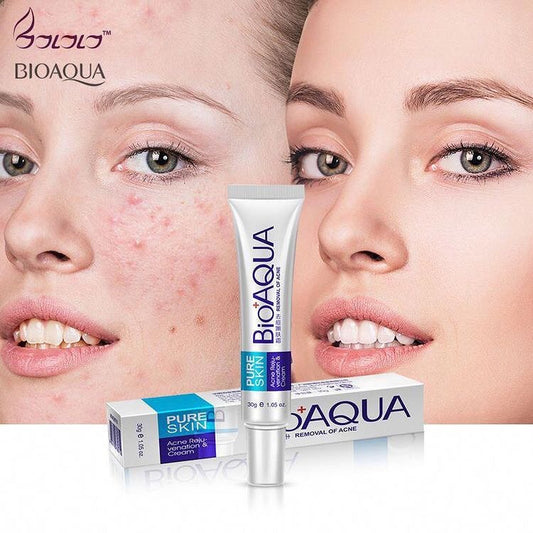 Bio aqua Acne Cream - Anti-Wrinkle Removal Cream Spots Scar Blemish Marks
